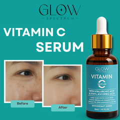 Brightening Serum - Vitamin c